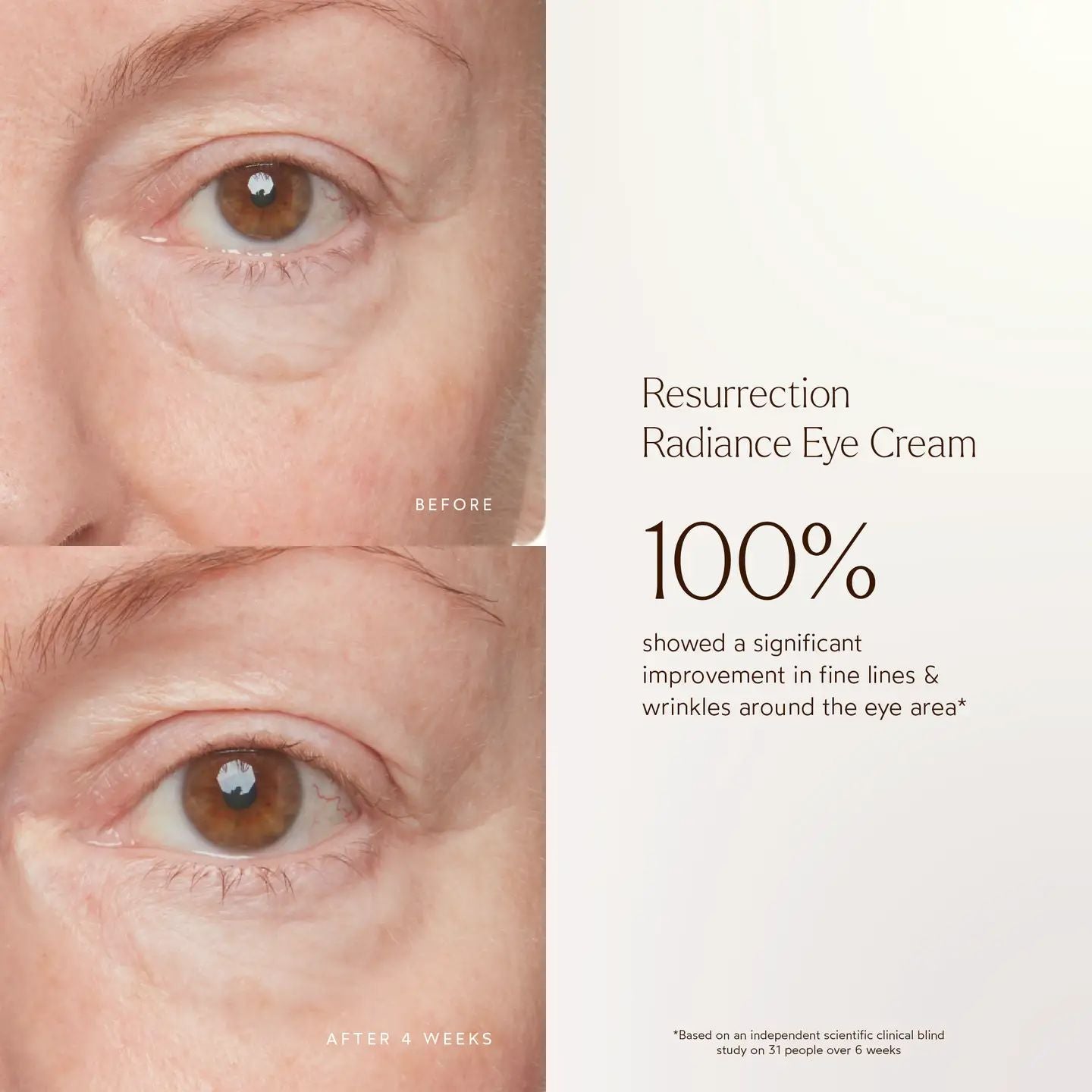 Renew Resurrection Radiance Eye Cream | TRUE BOTANICALS