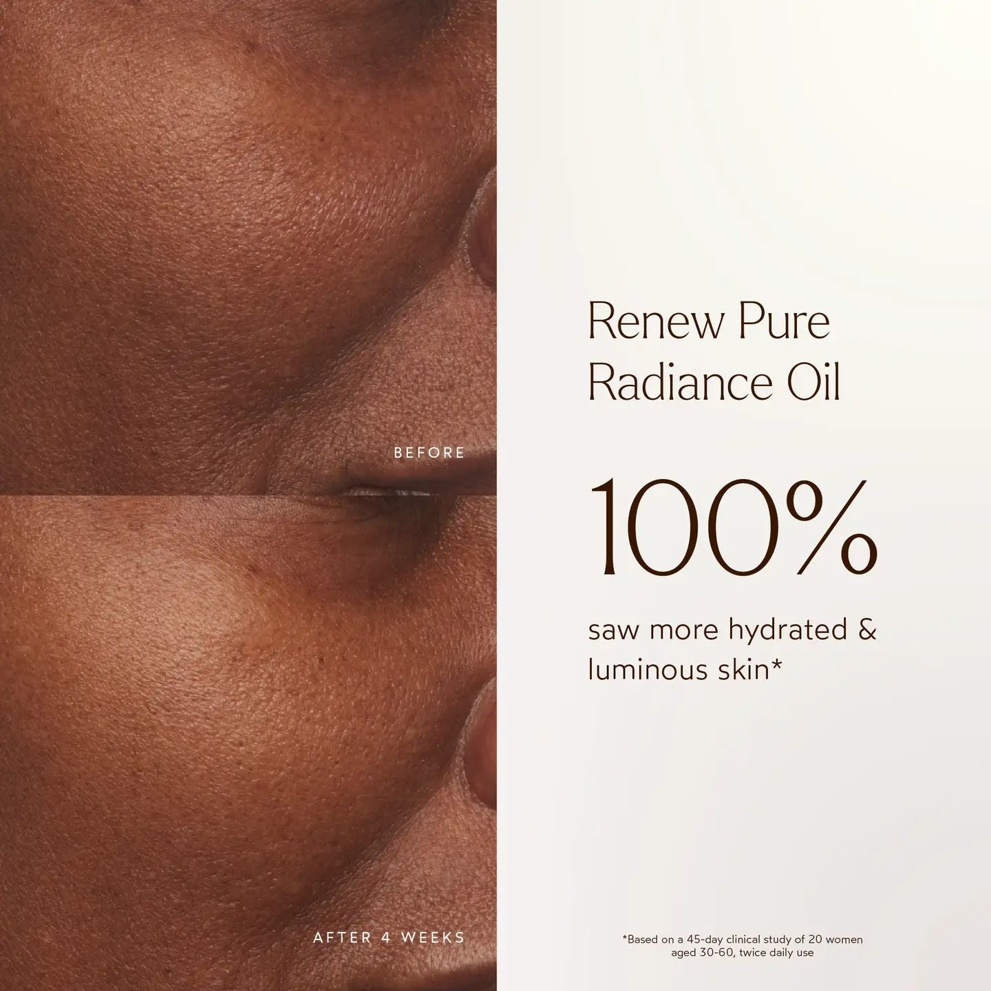 Renew Pure Radiance Oil | TRUE BOTANICALS
