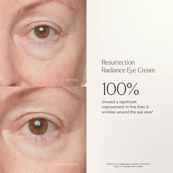 Renew Resurrection Radiance Eye Cream | TRUE BOTANICALS
