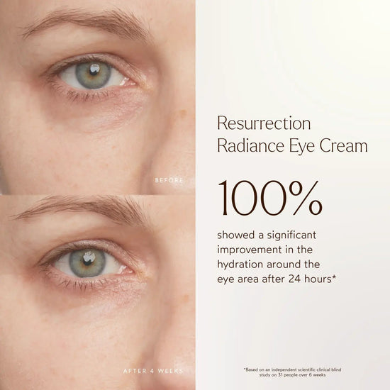 Renew Resurrection Radiance Eye Cream | TRUE BOTANICALS