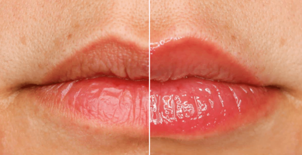 SCRANDIE BEAUTY Spicy Sauce - Extreme Lip Plumper