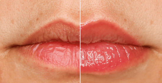 SCRANDIE BEAUTY Spicy Sauce - Extreme Lip Plumper