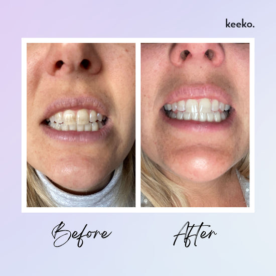 Botanical Teeth Whitening Pen | KEEKO
